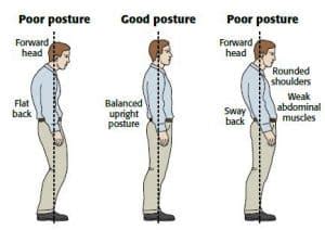 7 Causes of Postural Defects - Sutured