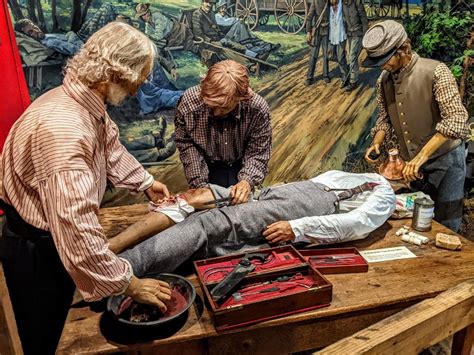 Civil War Medicine Amputation