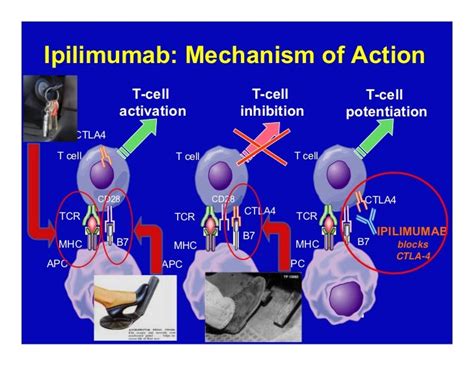 Systemic Treatments for Uveal Melanoma