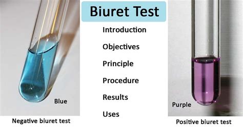 [Biochem concept help] Biuret test: How does the tone of the purple ...