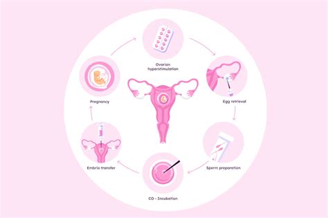 Comprehensive IVF Process Guide: Start to Finish