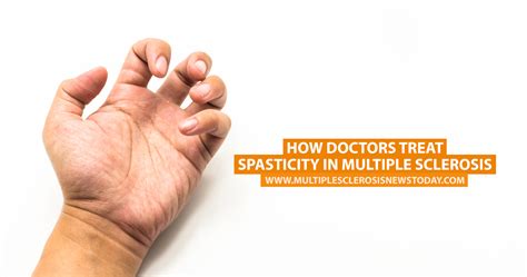 How Doctors Treat Spasticity in Multiple Sclerosis | Multiple Sclerosis ...