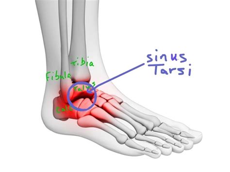 Posts about swelling on walkwellstaywell | Sinusitis, Tarsus, Foot exercises