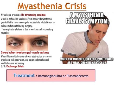 Surgery to remove the thymus gland in patients with myasthenia gravis (MG) provides significant ...