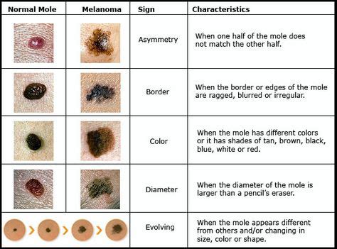 Pictures Of | Pet cancer, Dog skin, Pictures of moles