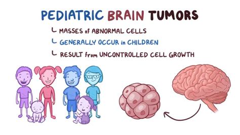 Understanding Brain Tumors In Children - Ask The Nurse Expert