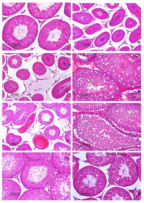 Testis Slide Seminiferous Tubules