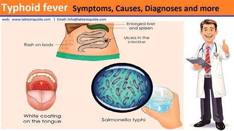 Typhoid Fever Symptoms, Causes, Diagnoses, Treatment And More | Lab Tests Guide