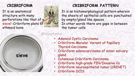 CRIBRIFORM PATTERN : #patternsinhistopathology - Pathology Made Simple