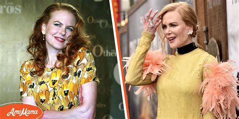 Has Nicole Kidman Had Plastic Surgery? The Actress's Face Has Been ...