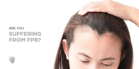 Female Pattern Baldness - Symptoms, Causes, Treatment and Prevention - AHS India