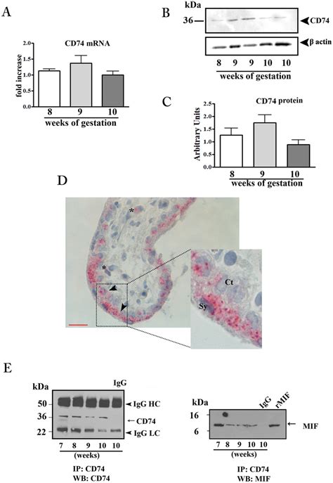 CD74 expression in first trimester placental tissues and interaction... | Download Scientific ...