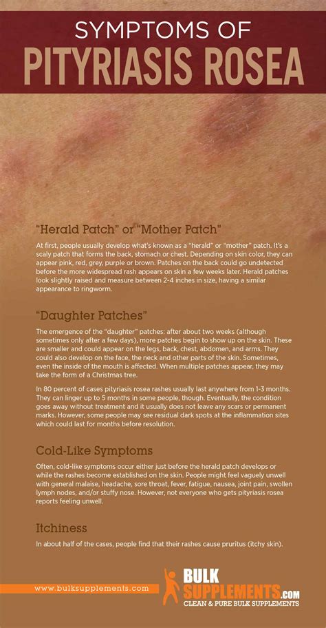 Pityriasis Rosea: Symptoms, Causes & Treatment