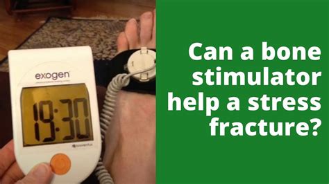 Can a bone stimulator help a stress fracture? - YouTube