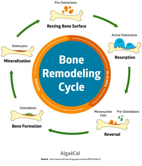 Osteomalacia Overview: Causes, Symptoms, Diagnosis, Treatment & FAQ