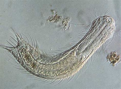 PHYLUM GASTROTRICHA