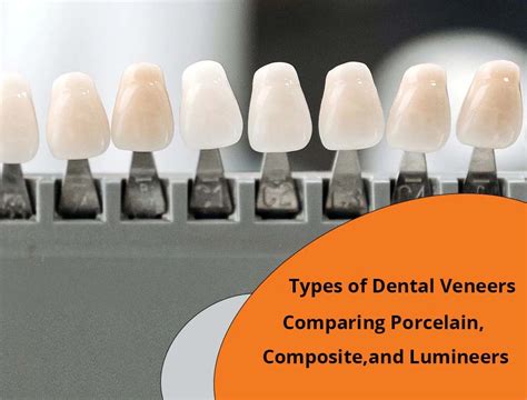 Types of Dental Veneers: Comparing Porcelain, Composite, and Lumineers ...