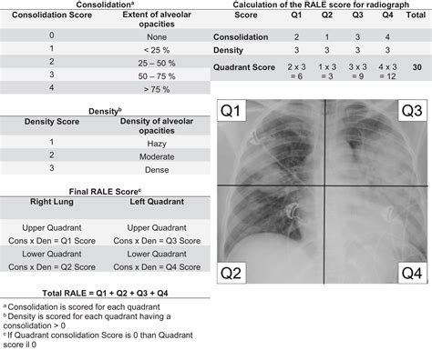 Ards Chest X Ray