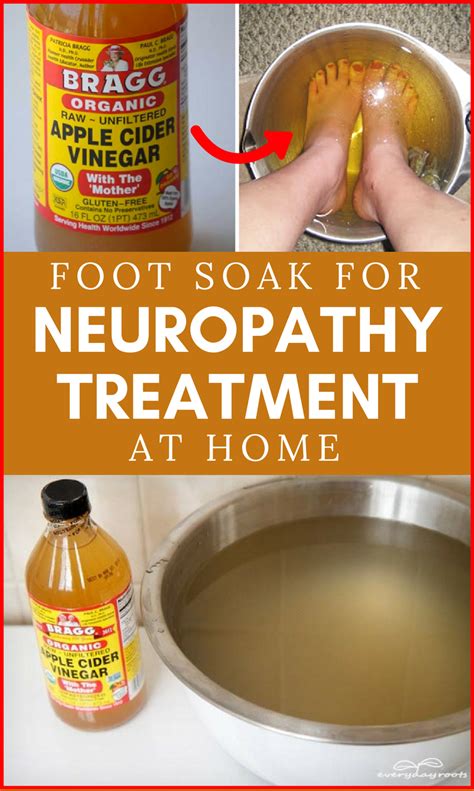 Foot Soak for Neuropathy Treatment at Home (With images) | Neuropathy treatment, Health remedies ...