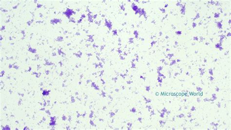 Microscope World Blog: Tetanus Bacteria Under the Microscope