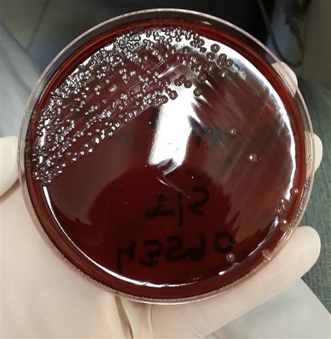 Morphology & Culture Characteristics of Neisseria meningitidis (Meningococcus)