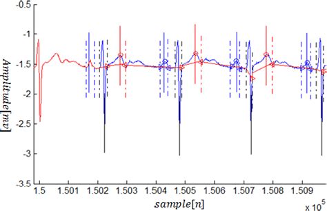 Figure 1 from P-Waves and T-Wave Detection Algorithm in the ECG Signals ...