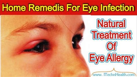 Easy Home Remedies For Eye Infection Treatment of Conjunctivitis ...