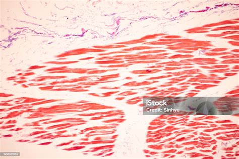Otot Lurik Manusia Di Bawah Mikroskop Foto Stok - Unduh Gambar Sekarang - Anatomi, Aorta, Belang ...