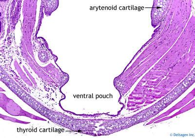 Larynx Histology - Larynx (labels) - histology slide