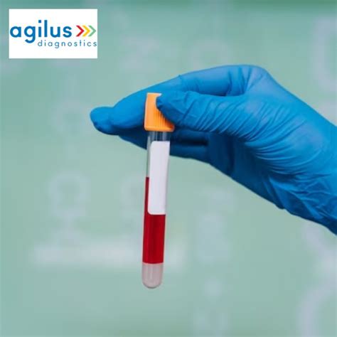 Agilus Diagnostics