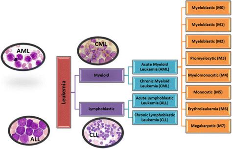 Major types of leukemia: AML- acute myeloid leukemia; ALL- acute... | Download Scientific Diagram