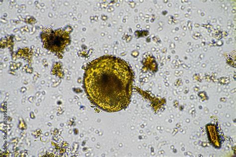 soil microorganisms in a soil sample, soil fungus and bacteria on a ...