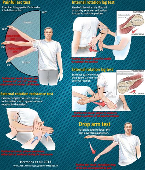 Pin on PT studying board