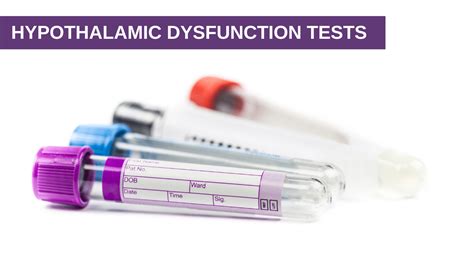 Hypothalamic Dysfunction Tests - Genesis Gold ® Hypothalamus