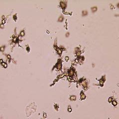 Urinalysis Crystals to Physiology of urine formation Flashcards - Cram.com