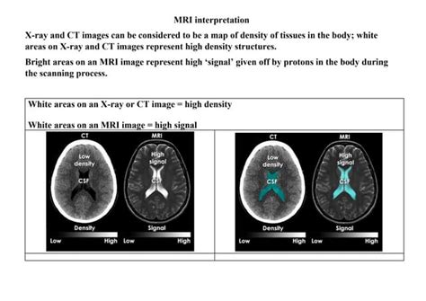 1. MRI interpretation.docx