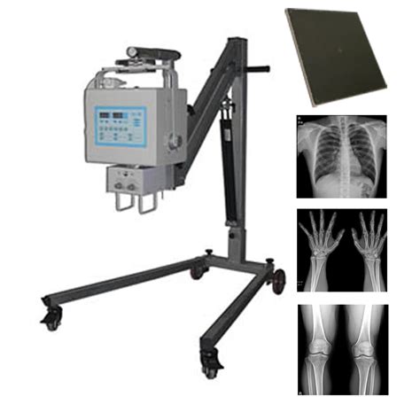 Hospital Digital Portable X Ray Machine,Portable X-ray Equipment - Buy Portable X Ray Machine,X ...