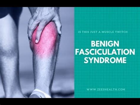 Benign Fasciculation Syndrome Symptoms and Causes - Diagnosis ...