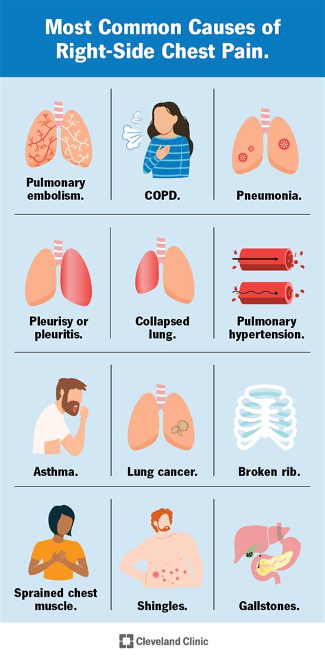 Common Causes Of Chest Pain - Ask The Nurse Expert