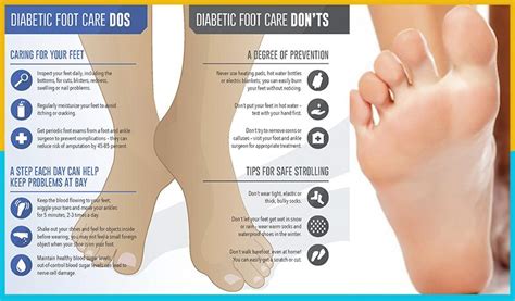 Signs & Complications of Diabetes Foot Problems for Diabetic Patients ...