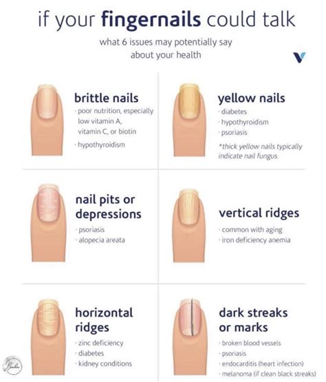 Some Common Nail Diseases and How to Treat Them - NAILCON