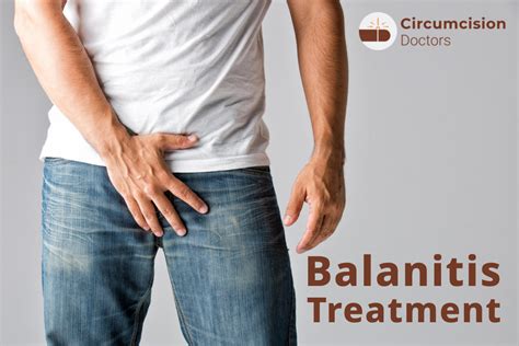 Balanitis Treatment - Surgery Procedure, Recovery & Risks