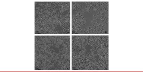 Electron microscopy exhibited the schwann cell in these four groups.... | Download Scientific ...