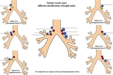 Demarcated by bronchial or vascular landmarks? a study on the lower ...