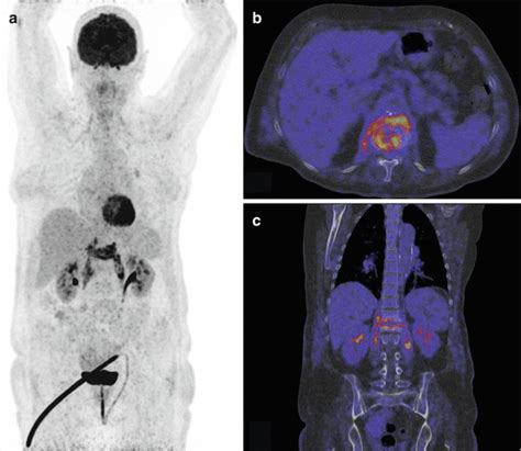 Nuclear Medicine Imaging Techniques | Radiology Key