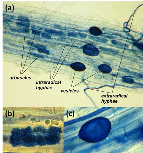 Can anyone identify these fungal structures stained with Trypan Blue?