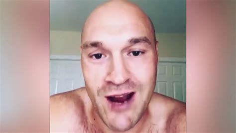 Tyson Fury explains why he declined hair transplant from world-renowned ...