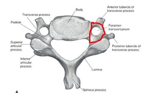 Transverse Foramen Fractures | Bone and Spine