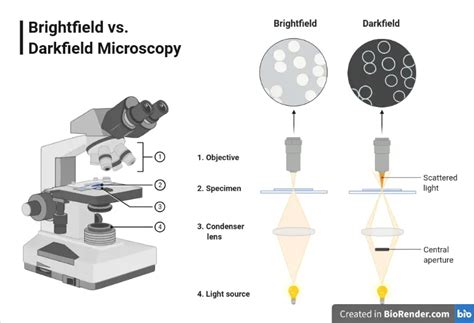 Dark-field Microscopy: Principle and Uses • Microbe Online