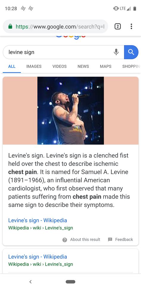 Levine's sign. : r/nursing